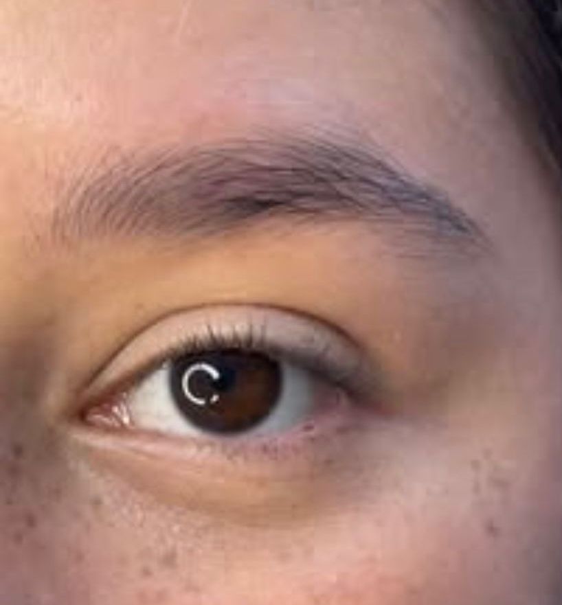 Resultado Flow Lash — antes