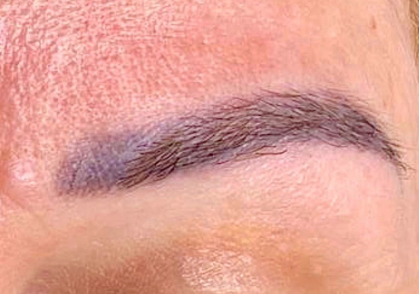 Exobrows resultado 1 — antes