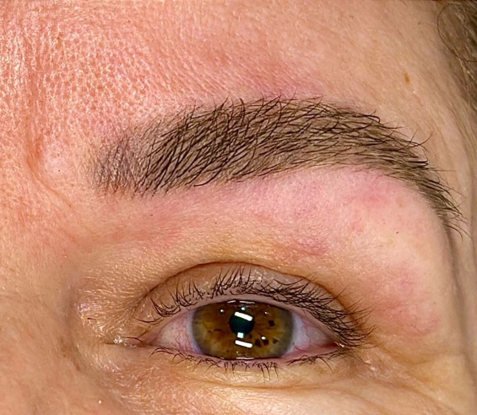 Exobrows resultado 1 — depois