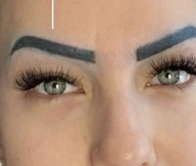 Exobrows resultado 2 — antes