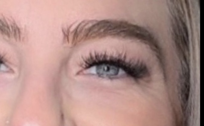 Exobrows resultado 2 — depois